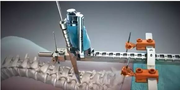 老齡化社會下的醫療設備需求